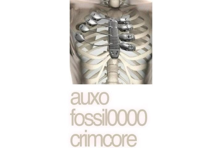 Image for event: AUXO.